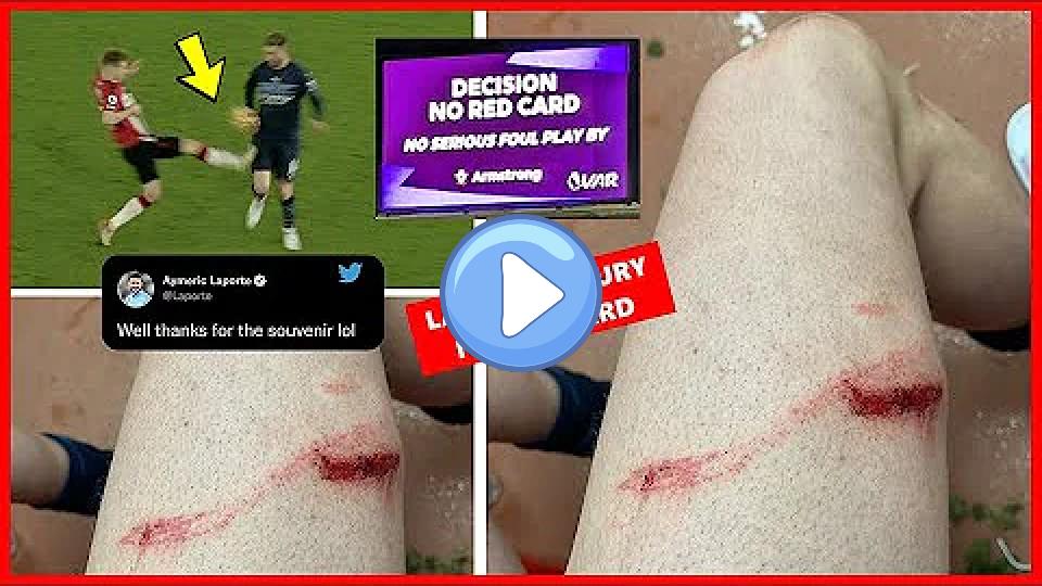 Play video: Aymeric Laporte Suffers Thigh Injury Against Southampton | Armstrong's Studs-Up Tackle on Laporte 😡 Video thumb: Aymeric Laporte Suffers Thigh Injury Against Southampton | Armstrong's Studs-Up Tackle on Laporte 😡