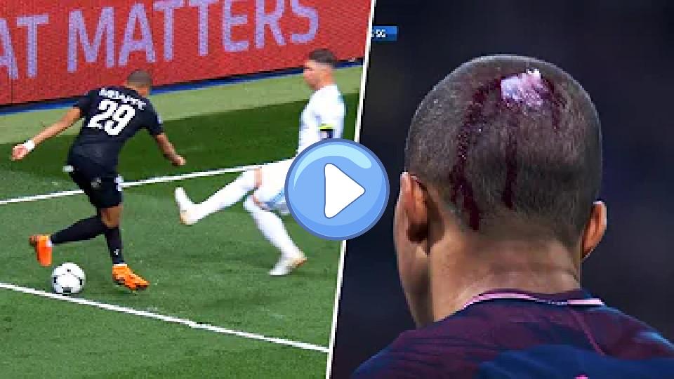 Play video: 10 Horrific Tackles on Kylian Mbappe Video thumb: 10 Horrific Tackles on Kylian Mbappe