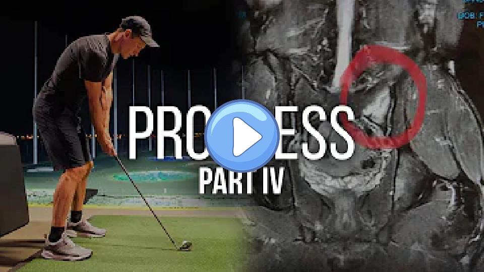 Play video: End of the Injury Series Video thumb: End of the Injury Series