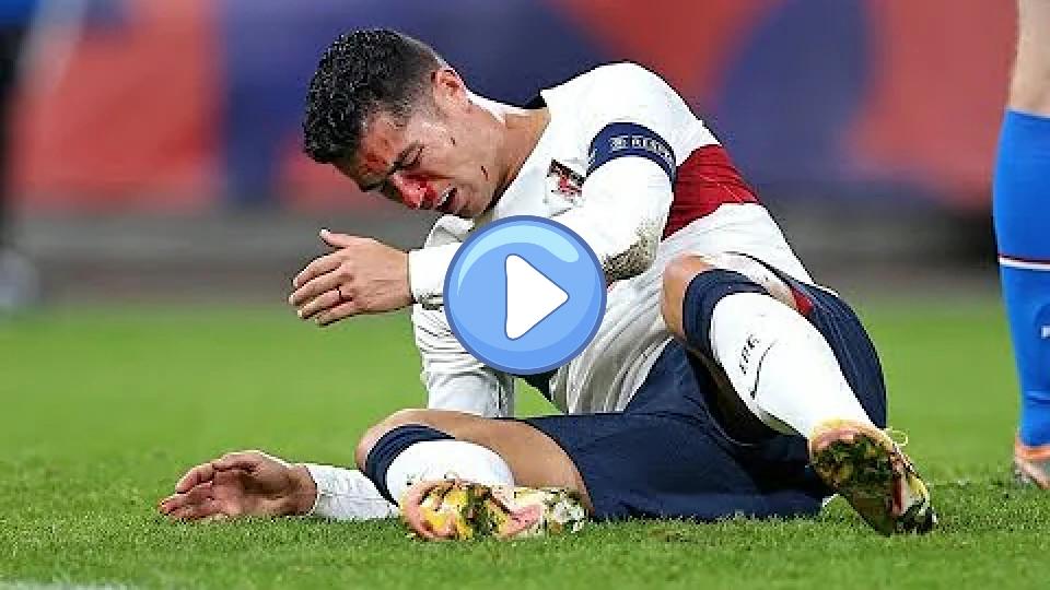 Video thumb: Cristiano Ronaldo's nose injury 😱 against the Czech Republic