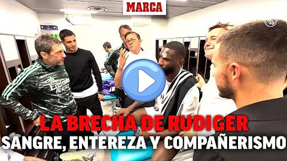 Play video: This is how Rudiger's injury was handled in the locker room: blood, resilience, and great camaraderie I MARCA Video thumb: This is how Rudiger's injury was handled in the locker room: blood, resilience, and great camaraderie I MARCA