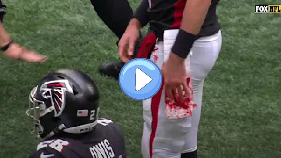 Play video: Matt Ryan's hand was bloody after getting cleated. Video thumb: Matt Ryan's hand was bloody after getting cleated.