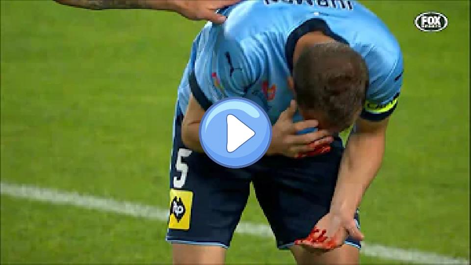 Play video: Matt Jurman's head injury Video thumb: Matt Jurman's head injury