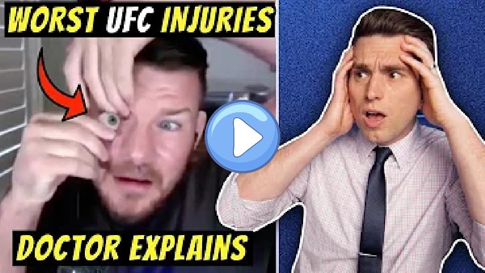 Play video: Worst UFC Injuries Ever! Doctor Explains Shocking Michael Bisping Eye Injury Story Video thumb: Worst UFC Injuries Ever! Doctor Explains Shocking Michael Bisping Eye Injury Story